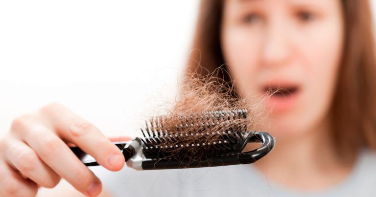 Causes of Hair loss
