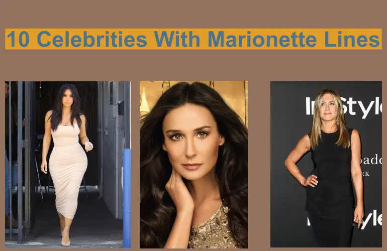 Celebrities With Marionette Lines
