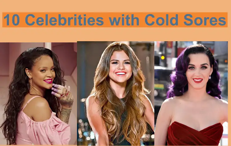 10 Celebrities with Cold Sores