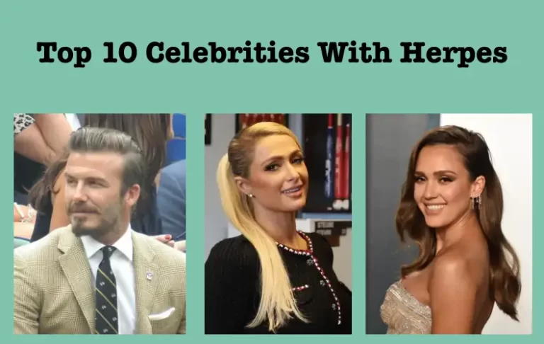 Celebrities With Herpes