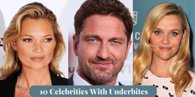 10 Celebrities With Underbites
