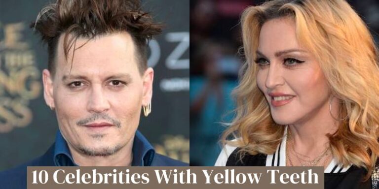 10 Celebrities With Yellow Teeth