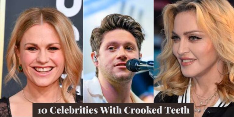 10 Celebrities With Crooked Teeth